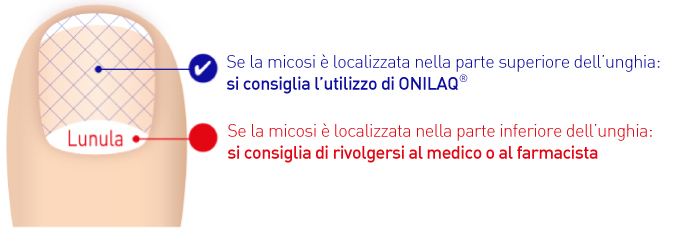 Ekzoderit per unghie di mani il prezzo